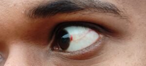 नवोदय विद्यालय बोरई में छात्र से मारपीट का आरोप, शिकायतों के बावजूद कार्रवाई नहीं, संरक्षण के आरोप